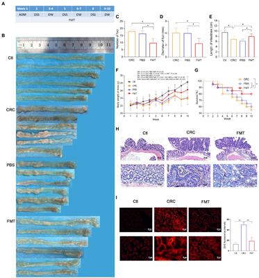 Fecal microbiota transplantation inhibits colorectal cancer progression: Reversing intestinal microbial dysbiosis to enhance anti-cancer immune responses